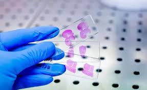 ihc test
